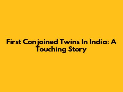 First Conjoined Twins In India: A Touching Story