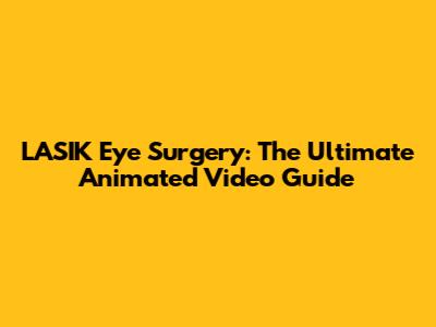 LASIK Eye Surgery: The Ultimate Animated Video Guide