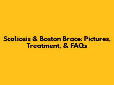 Scoliosis & Boston Brace: Pictures, Treatment, & FAQs